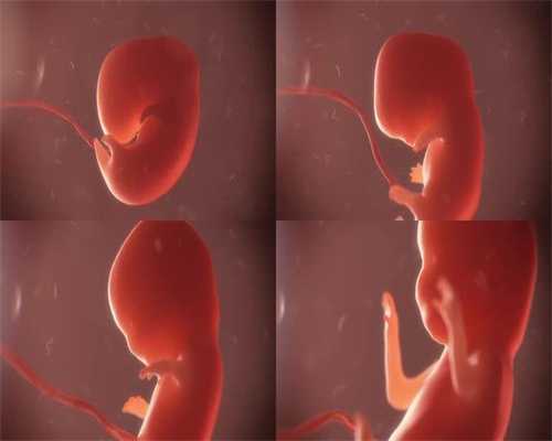 皇家生殖遗传医院期间，孕妇吃什么有助于排胎毒别急，看
