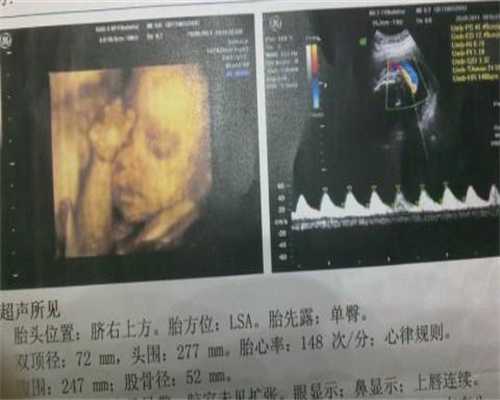 南京有皇家生殖遗传医院的吗：初三情侣偷吃禁果16岁少女助孕