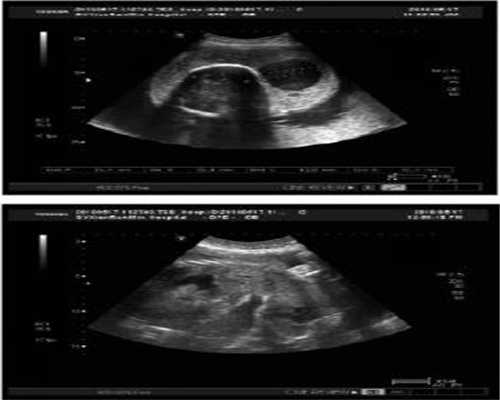 助孕7个月胎儿发育标准