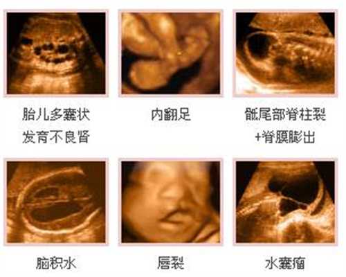 助孕1-40周完美食谱：泰国专业皇家生殖遗传医院机构